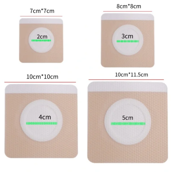 Silicone acupoint patch – medical grade waterproof tape