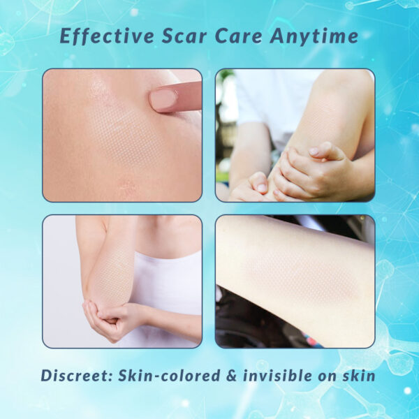 Flexible Silicone Scar Sheets for Comfortable Adhesion