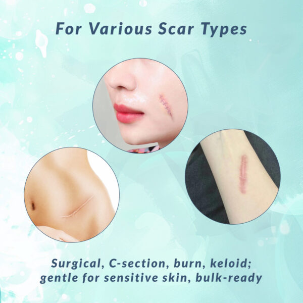 scar sheets silicone medical adhesive tape